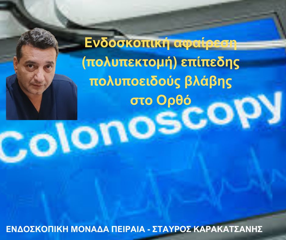 Ενδοσκοπική αφαίρεση (πολυπεκτομή) επίπεδης πολυποειδούς βλάβης στο Ορθό από τον Δρ Σταύρο Καρακατσάνη
