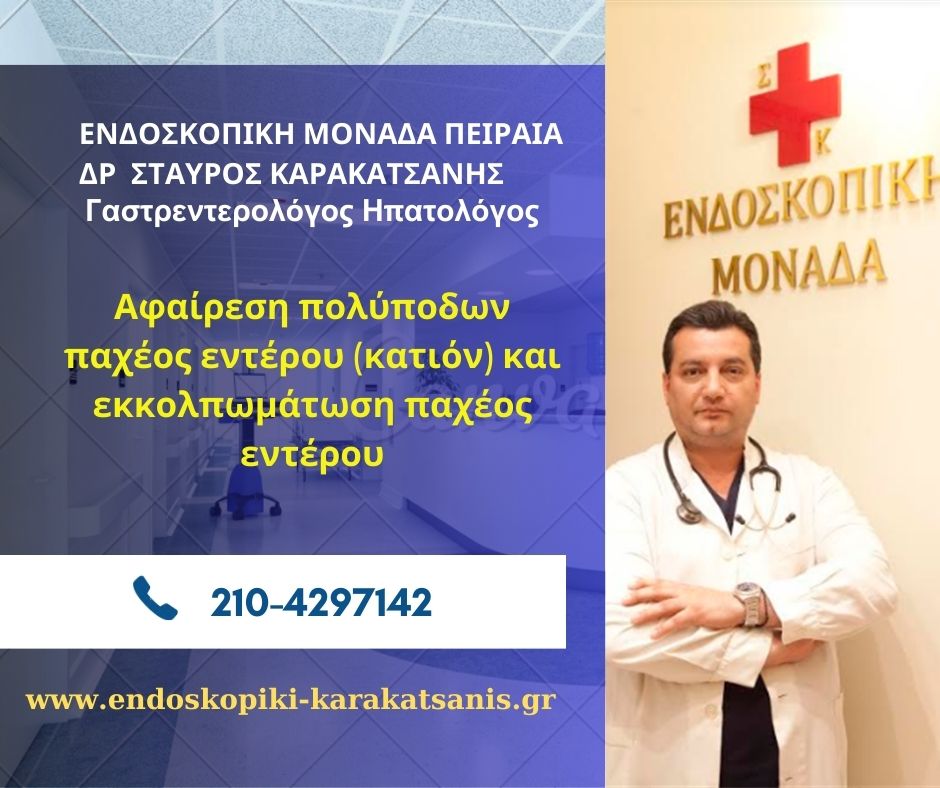 Αφαίρεση πολύποδων παχέος εντέρου (κατιόν) και εκκολπωμάτωση παχέος εντέρου