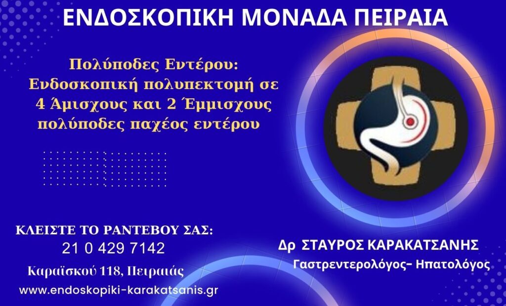 Πολύποδες Εντέρου: Ενδοσκοπική πολυπεκτομή σε 4 Άμισχους και 2 Έμμισχους πολύποδες κατά μήκος του παχέος εντέρου