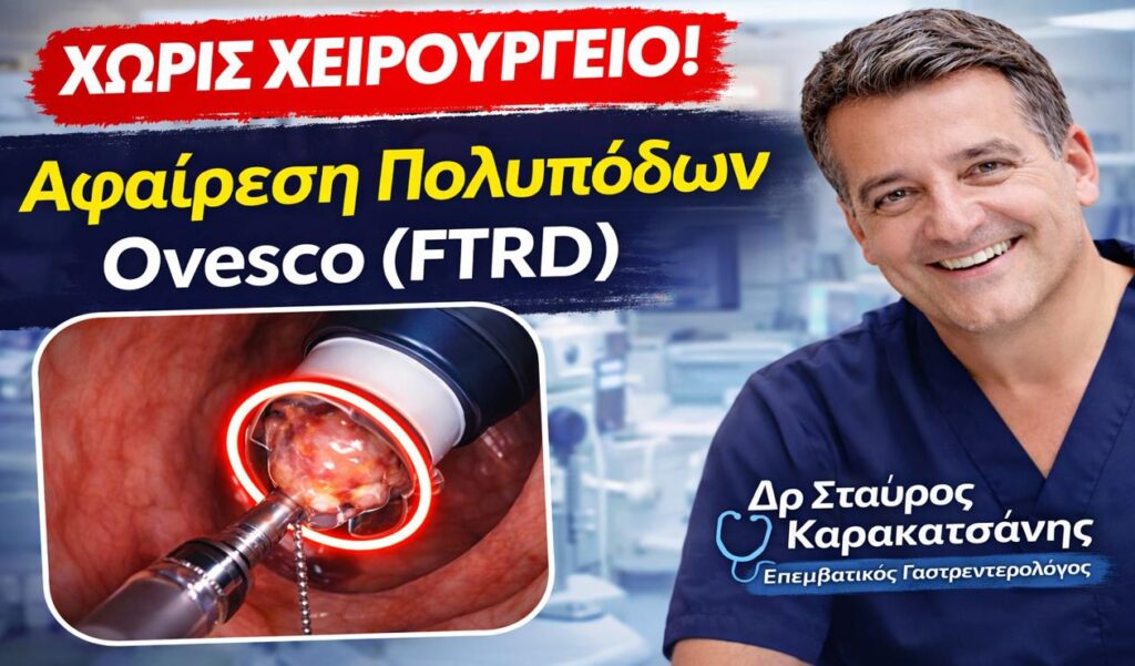 Τοποθέτηση Ovesco (FTRD): Αφαίρεση πολυπόδων χωρίς χειρουργείο από τον Δρ Σταύρο Καρακατσάνη