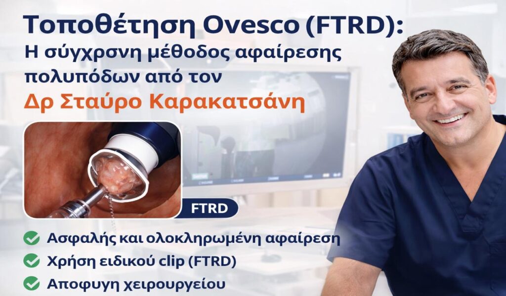 Τοποθέτηση Ovesco (FTRD): Αφαίρεση πολυπόδων χωρίς χειρουργείο από τον Δρ Σταύρο Καρακατσάνη