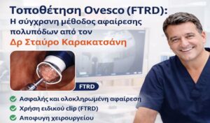 Τοποθέτηση Ovesco (FTRD): Αφαίρεση πολυπόδων χωρίς χειρουργείο από τον Δρ Σταύρο Καρακατσάνη