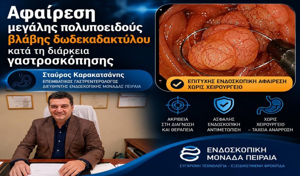 Αφαίρεση μεγάλης πολυποειδούς βλάβης δωδεκαδακτύλου κατά τη διάρκεια γαστροσκόπησης | Σταύρος Καρακατσάνης