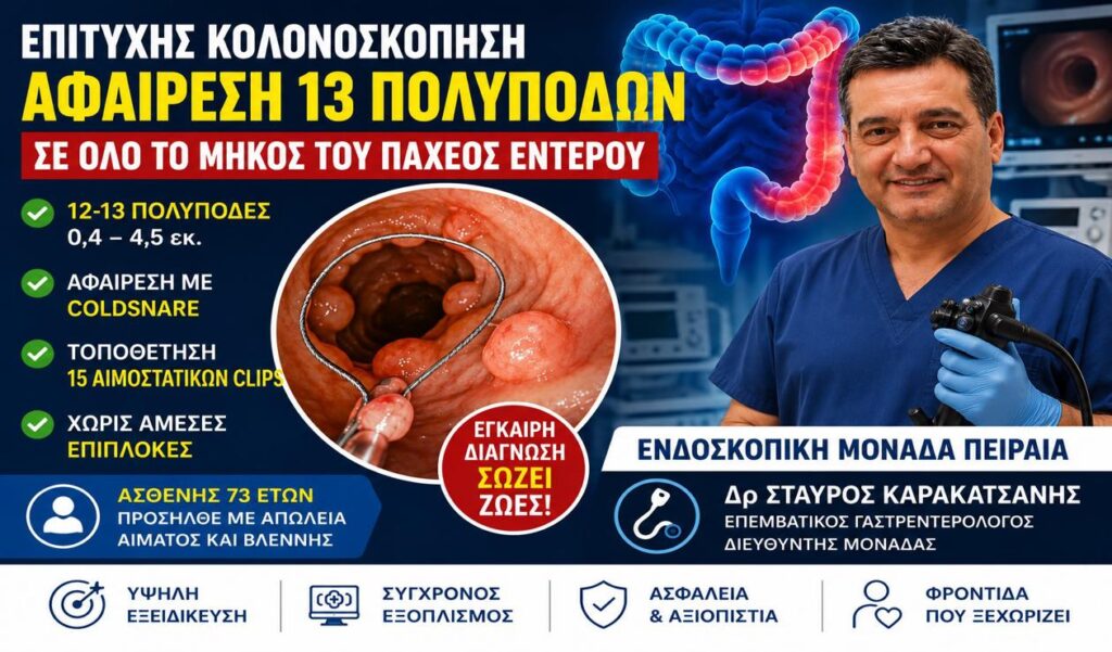 Κολονοσκόπηση με Αφαίρεση 13 Πολυπόδων στον Πειραιά | Δρ Σταύρος Καρακατσάνης