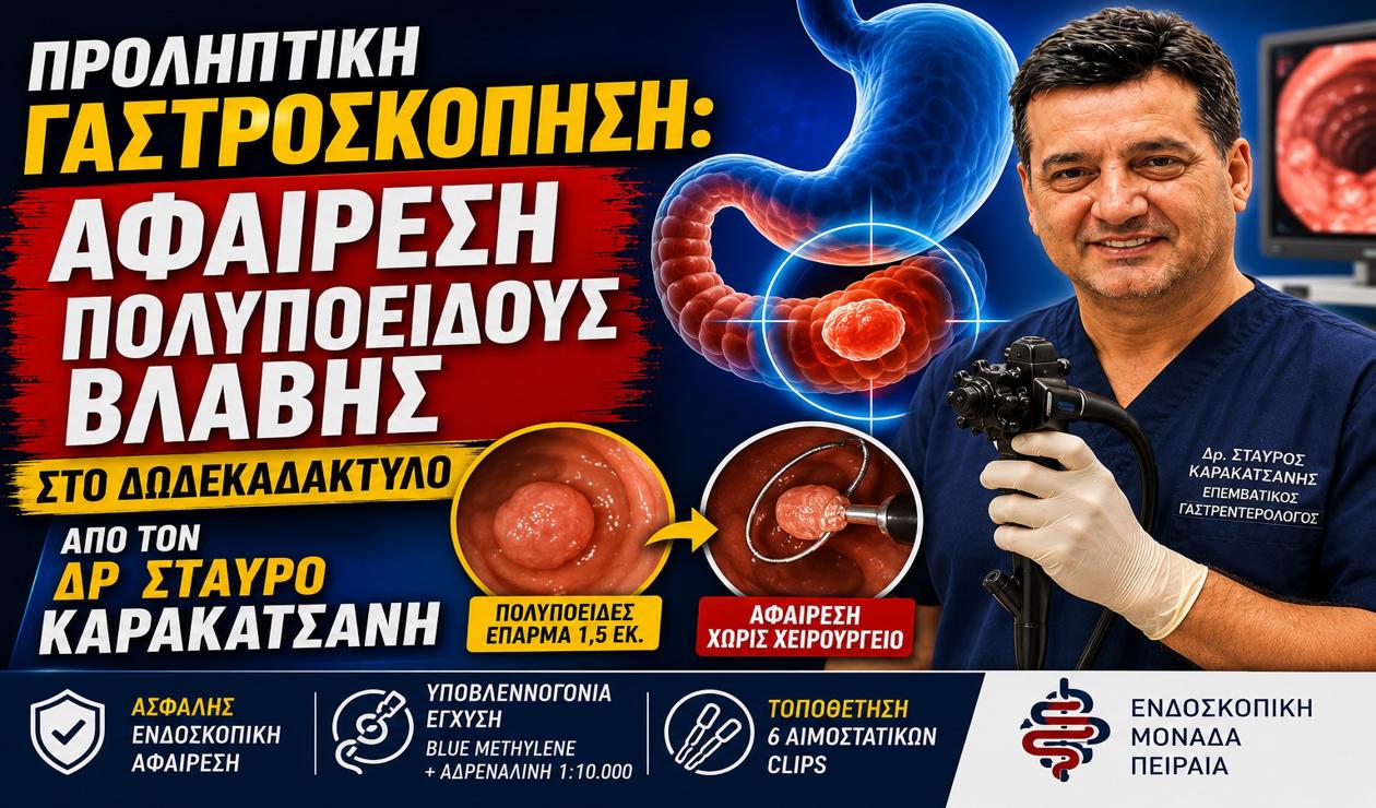 Προληπτική Γαστροσκόπηση: Αφαίρεση Πολυποειδούς Βλάβης στο Δωδεκαδάκτυλο από τον Δρ Σταύρο Καρακατσάνη