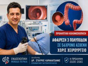 Προληπτική Κολονοσκόπηση: Αφαίρεση 3 Μεγάλων Πολυπόδων σε 56χρονο χωρίς Χειρουργείο | Ενδοσκοπική Μονάδα Πειραιά