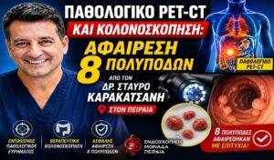 Παθολογικό PET-CT και Κολονοσκόπηση: Αφαίρεση 8 Πολυπόδων από τον Δρ. Σταύρο Καρακατσάνη στον Πειραιά