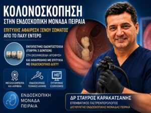 Κολονοσκόπηση στον Πειραιά: Αφαίρεση Ξένου Σώματος από τη Σκωληκοειδή Απόφυση