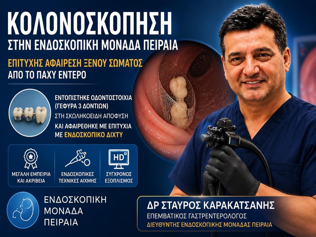 Κολονοσκόπηση στον Πειραιά: Αφαίρεση Ξένου Σώματος από τη Σκωληκοειδή Απόφυση