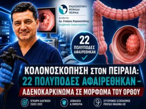 Κολονοσκόπηση στον Πειραιά: 22 Πολύποδες Αφαιρέθηκαν – Αδενοκαρκίνωμα σε Μόρφωμα του Ορθού