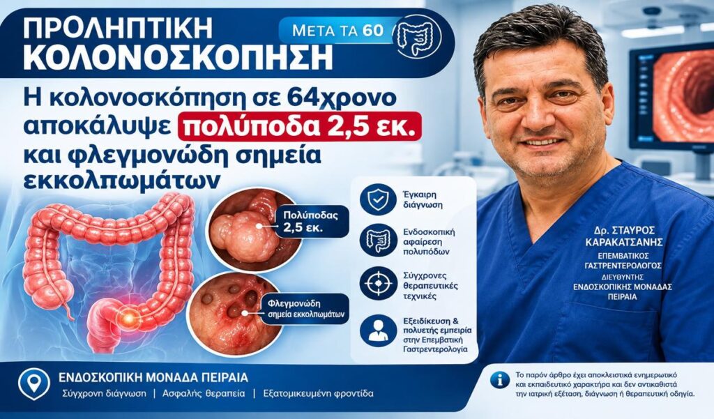 Στα 64 η προληπτική κολονοσκόπηση αποκάλυψε πολύποδα 2,5 εκ. και φλεγμονώδη σημεία εκκολπωμάτων